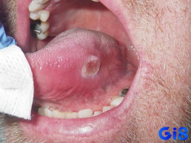 Chia sẻ kinh nghiệm cắn vào lưỡi đánh con lô gì tham khảo để áp dụng
